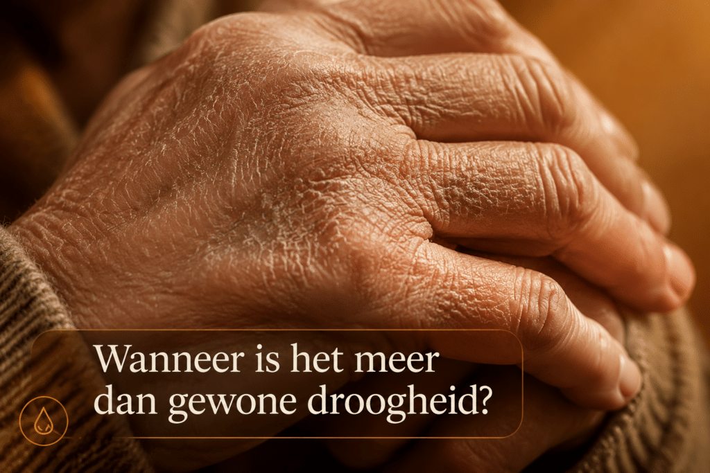 Wanneer is het meer dan gewone droogheid?