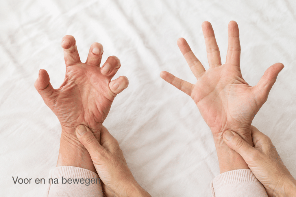 voor en na bewegen